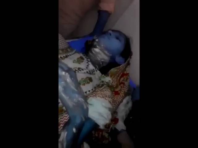 Girl Burnt Alive: Evidence of unimaginable tyranny! (Longer Video)