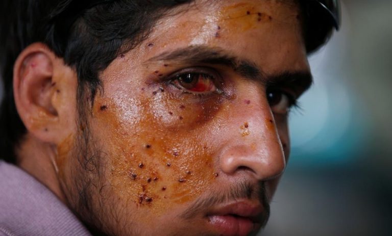 Attack on Indian Army in Uri, Kashmir, Pakistan & United States: Cui Bono? Who benefits and How